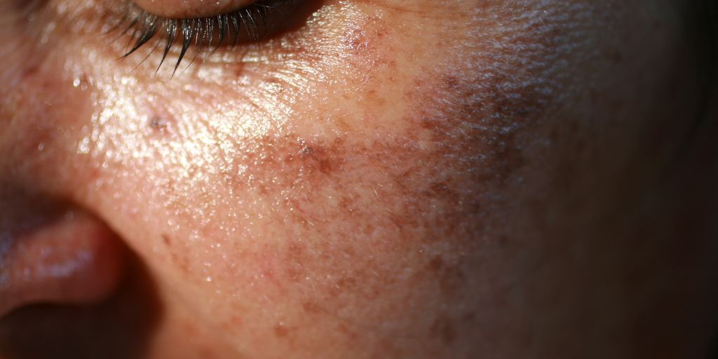 Femme avec le masque de grossesse